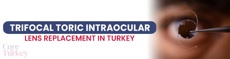 Trifocal Toric Intraocular Lens (Smart Lens)